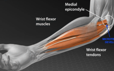 CBD for Tennis and Golf Elbow: A Natural Approach to Relieving Pain and Enhancing Recovery